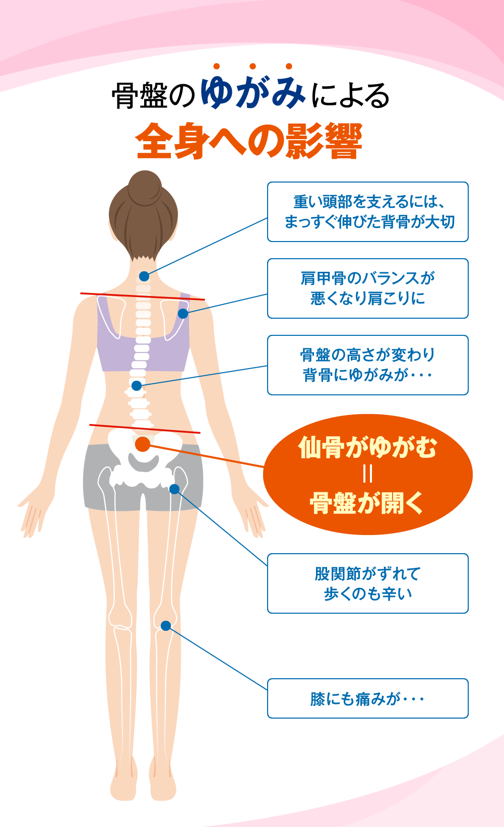 骨盤のゆがみによる全身への影響