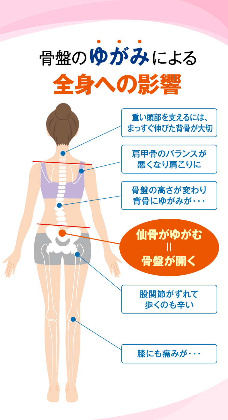 骨盤のゆがみによる全身への影響